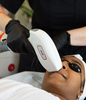 Laser and IPL hair removal treatments